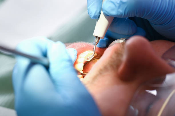 Best Broken or Chipped Tooth Repair in Westover, AL